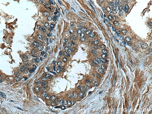 [67344-1-IG-20UL] FUT3 Monoclonal antibody