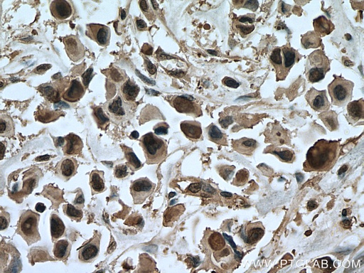 [67348-1-IG-150UL] ANAPC5 Monoclonal antibody