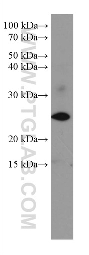 [67349-1-IG-150UL] SRY Monoclonal antibody