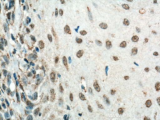 [67354-1-IG-20UL] HMG20B Monoclonal antibody