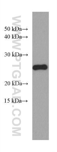 [67355-1-IG-20UL] P27; KIP1 Monoclonal antibody