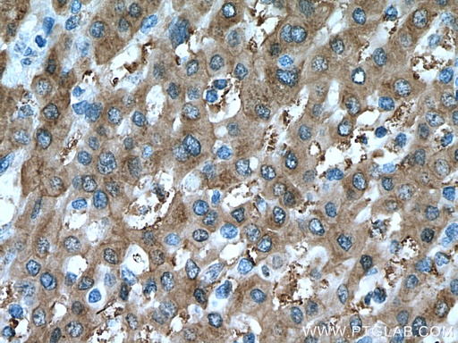 [67360-1-IG-150UL] UGDH Monoclonal antibody