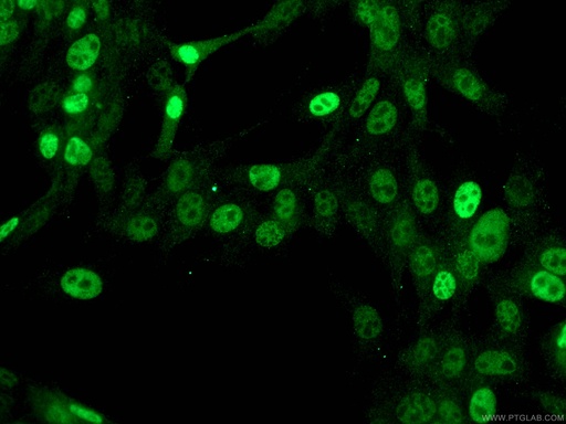 [67362-1-IG-150UL] p21 Monoclonal antibody