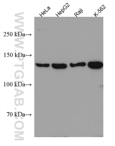 [67364-1-IG-150UL] HDAC9 Monoclonal antibody