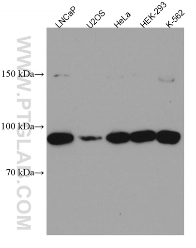 [67365-1-IG-20UL] FBXO11 Monoclonal antibody