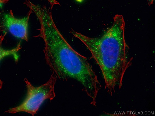 [67369-1-IG-150UL] PNPLA3 Monoclonal antibody