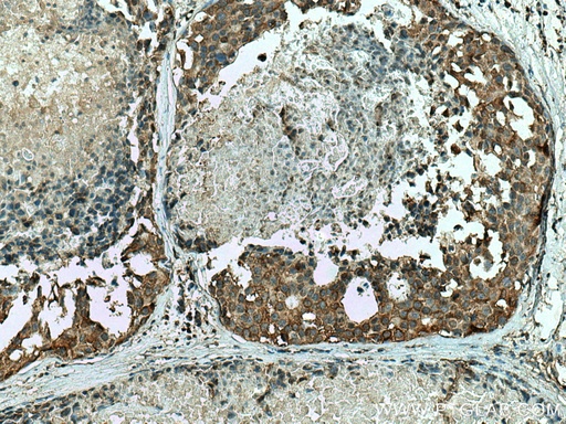 [67372-1-IG-150UL] ALDH9A1 Monoclonal antibody