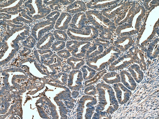 [67377-1-IG-150UL] HOMER2 Monoclonal antibody