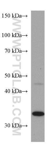[67382-1-IG-150UL] TUSC3 Monoclonal antibody