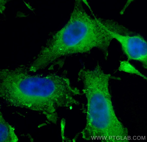 [67390-1-IG-20UL] PFN1 Monoclonal antibody