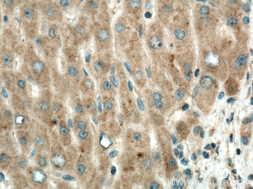[67392-1-IG-150UL] PPP4R1 Monoclonal antibody