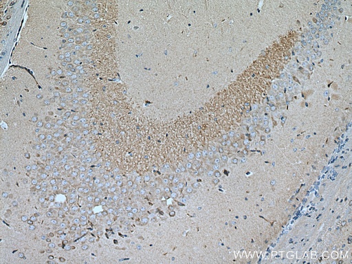 [67394-1-IG-150UL] RGS14 Monoclonal antibody