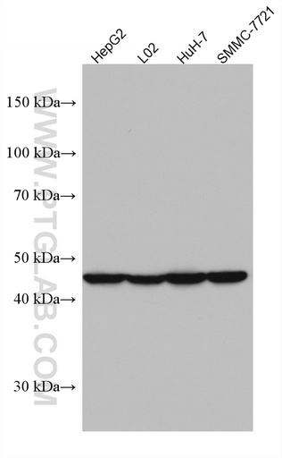 [67402-1-IG-20UL] AGXT Monoclonal antibody