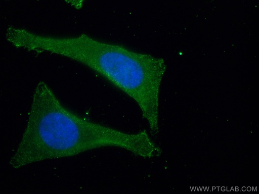 [67409-1-IG-150UL] SEC24D Monoclonal antibody