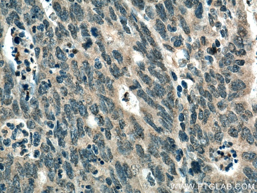 [67411-1-IG-20UL] TYK2 Monoclonal antibody