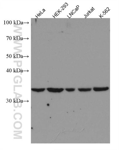 [67415-1-IG-20UL] Cyclin C Monoclonal antibody