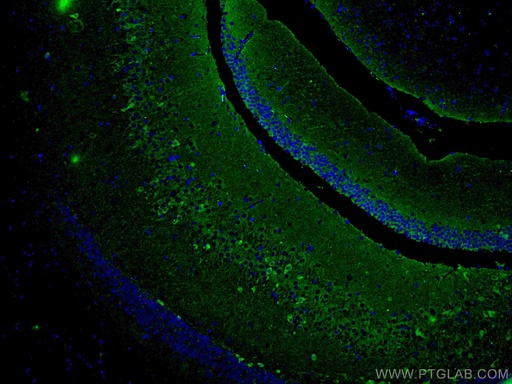 [67417-1-IG-20UL] ACVR1 Monoclonal antibody