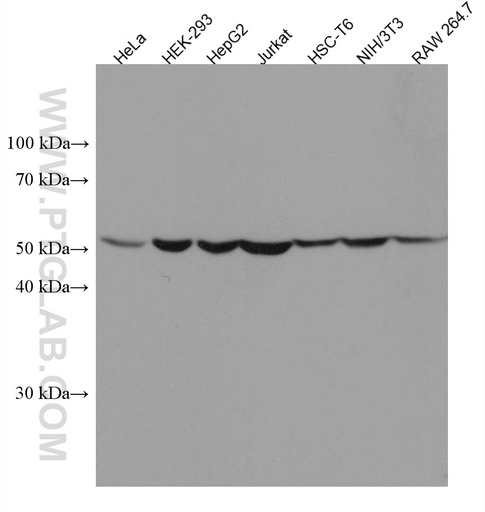[67419-1-IG-150UL] CYP2W1 Monoclonal antibody