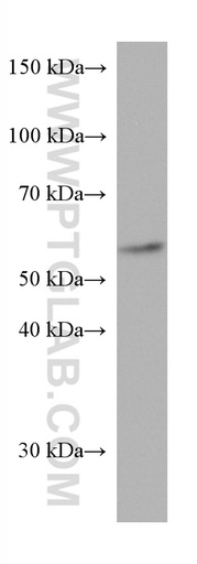 [67421-1-IG-20UL] CYP21A2 Monoclonal antibody