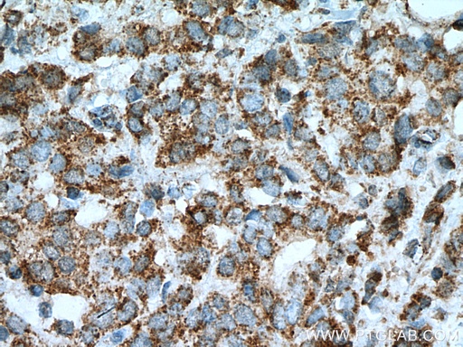 [67427-1-IG-20UL] KLK11 Monoclonal antibody