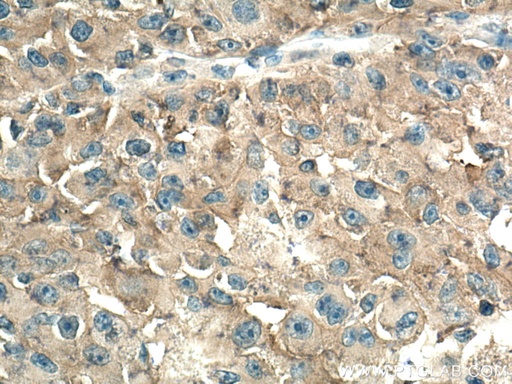 [67430-1-IG-20UL] AMPD2 Monoclonal antibody