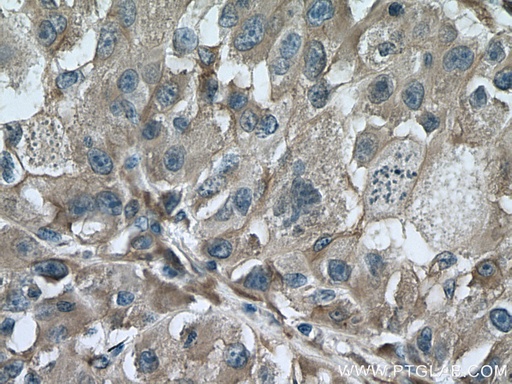 [67431-1-IG-150UL] TTPA Monoclonal antibody