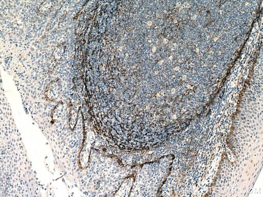 [67432-1-IG-20UL] Podoplanin Monoclonal antibody