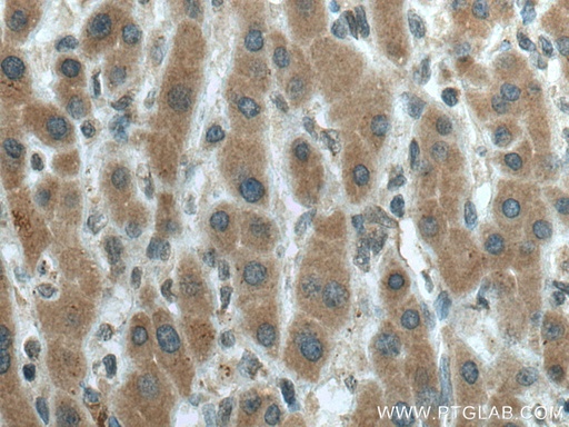 [67433-1-IG-20UL] CYP20A1 Monoclonal antibody
