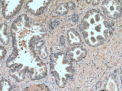 [67434-1-IG-150UL] LIPG Monoclonal antibody