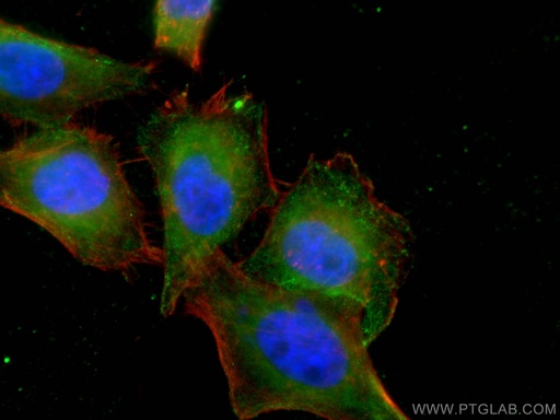 [67440-1-IG-150UL] PPM1D Monoclonal antibody