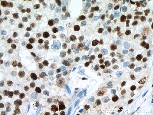 [67446-1-IG-150UL] MCM7 Monoclonal antibody