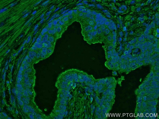 [67451-1-IG-150UL] TAOK3 Monoclonal antibody