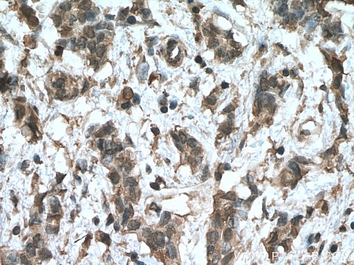 [67456-1-IG-20UL] HMBS Monoclonal antibody