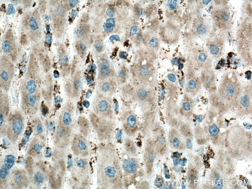 [67457-1-IG-150UL] ME2 Monoclonal antibody