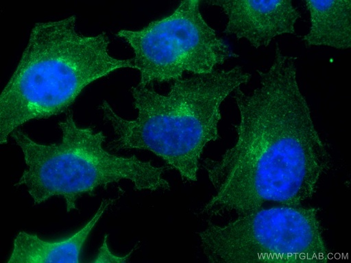 [67460-1-IG-150UL] CEP55 Monoclonal antibody