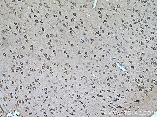 [67467-1-IG-150UL] SLC25A12 Monoclonal antibody