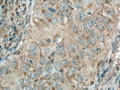[67468-1-IG-150UL] MGME1 Monoclonal antibody