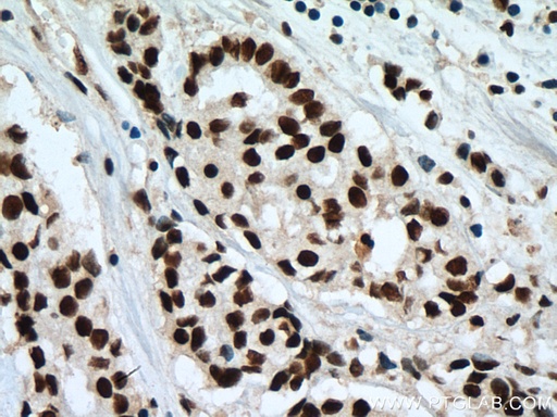 [67469-1-IG-150UL] SF3B3 Monoclonal antibody