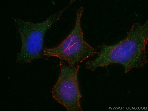 [67471-1-IG-150UL] PLCL2 Monoclonal antibody