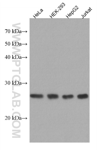 [67475-1-IG-20UL] MIS12 Monoclonal antibody
