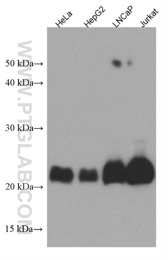 [67476-1-IG-150UL] MGMT Monoclonal antibody