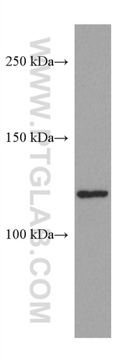 [67477-1-IG-20UL] ERAP2 Monoclonal antibody