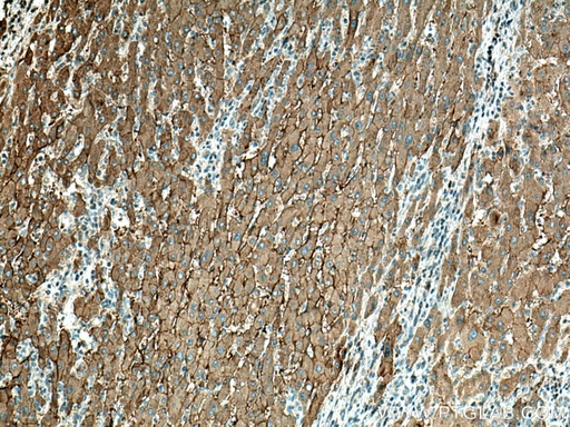 [67479-1-IG-20UL] SLC22A7 Monoclonal antibody
