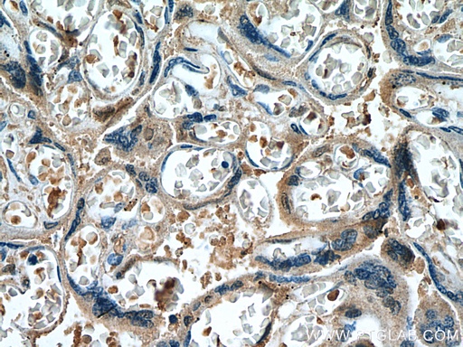 [67481-1-IG-20UL] FURIN Monoclonal antibody