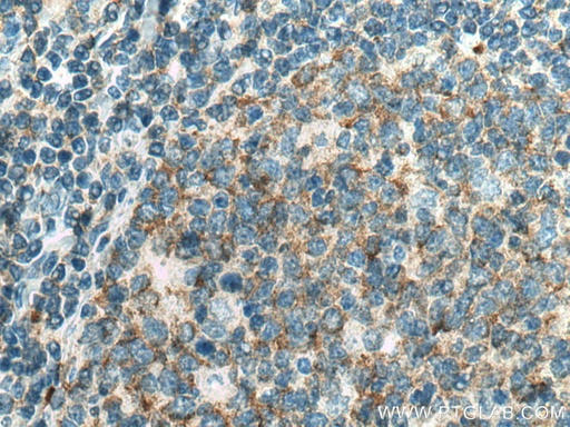 [67483-1-IG-20UL] PIP5K1A Monoclonal antibody