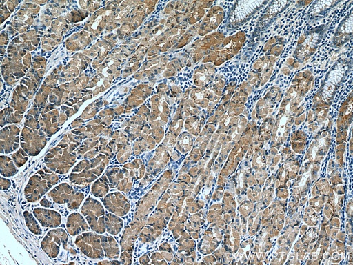 [67484-1-IG-150UL] AHCYL2 Monoclonal antibody