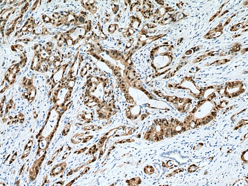 [67485-1-IG-20UL] S100P Monoclonal antibody