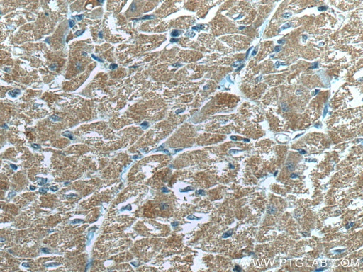 [67487-1-IG-20UL] MFN2 Monoclonal antibody