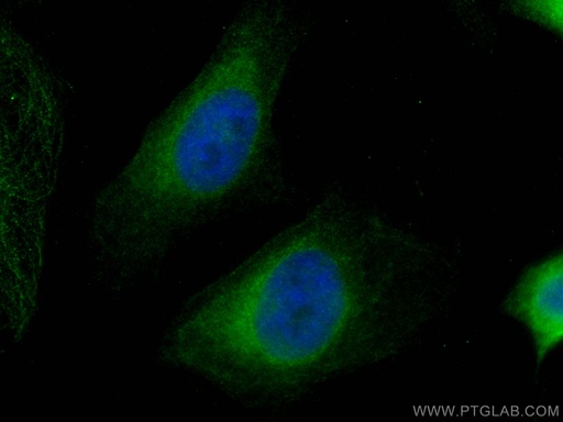 [67488-1-IG-150UL] HRD1/SYVN1 Monoclonal antibody