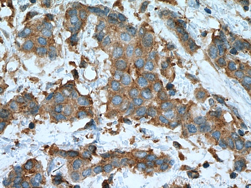 [67491-1-IG-20UL] PRKACA Monoclonal antibody